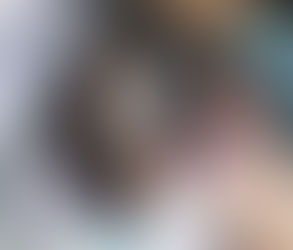 Laser Carbon Peel vs. Traditional Facial: Pros and Cons