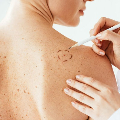 افضل طبيب أمراض جلدية في مسقط