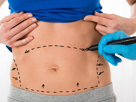 The Best Tummy Tuck Surgery Clinic In Oman for Women And What You Need to Know