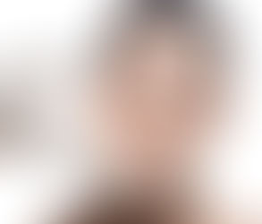 كيف يمكن أن تساعد جراحة التجميل في تعزيز علامتك التجارية الشخصية