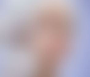 Does the Magic Facelift Use Radio Frequency or Ultrasound?