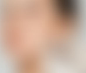 How Do Seasonal Changes Affect Cheek Filler Results?