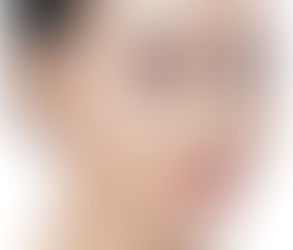 How to Protect Your Skin After Facelift Surgery: Tips from the Best Facelift Surgery Clinic in Oman