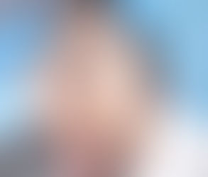 كيفية تقليل ظهور البثور بعد عملية زراعة الشعر