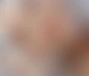 HydraFacial for Natural Skin Radiance