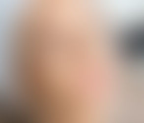 كيف يدعم جهاز أوكسجينيو للوجه التصريف الليمفاوي للحصول على وجه أنحف