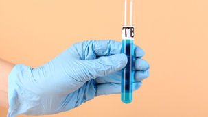 En Çok Öldüren Bulaşıcı Hastalık: Tüberküloz.