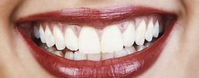 smile 4