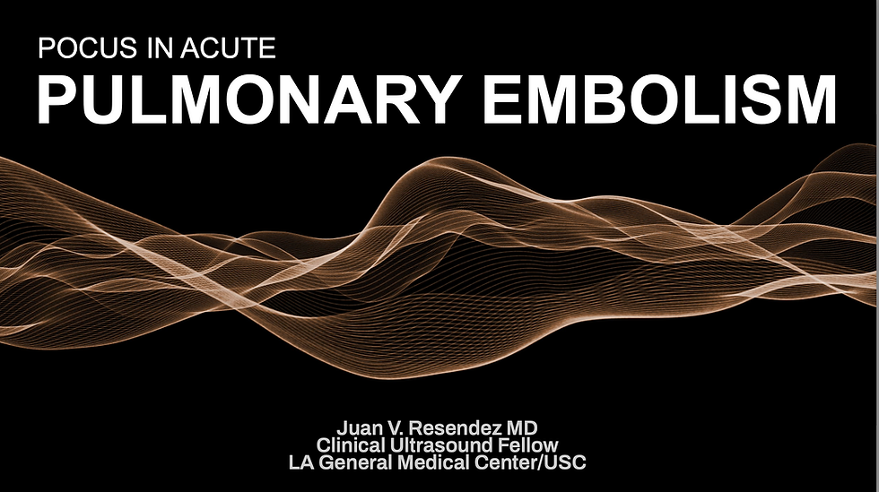 POCUS in Acute Pulmonary Embolism