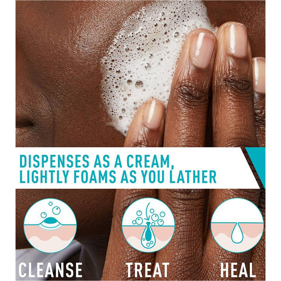 CeraVe® Acne Foaming Cream Cleanser - MCK-1229987_mktg.jpg