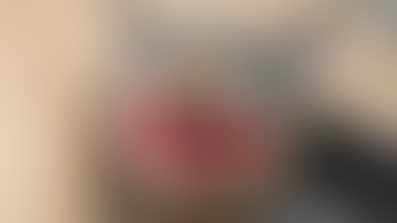 Is Stomatitis Contagious in Cats?