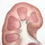 Thumbnail: Kidney