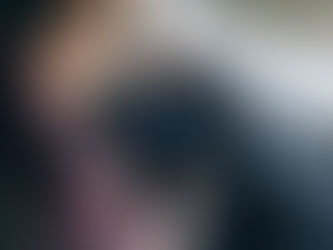 How the Eggshell Skull Rule Works in Car Accident Claims