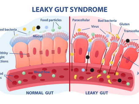 Leaky Gut Syndrome (sindrome dell'intestino gocciolante)