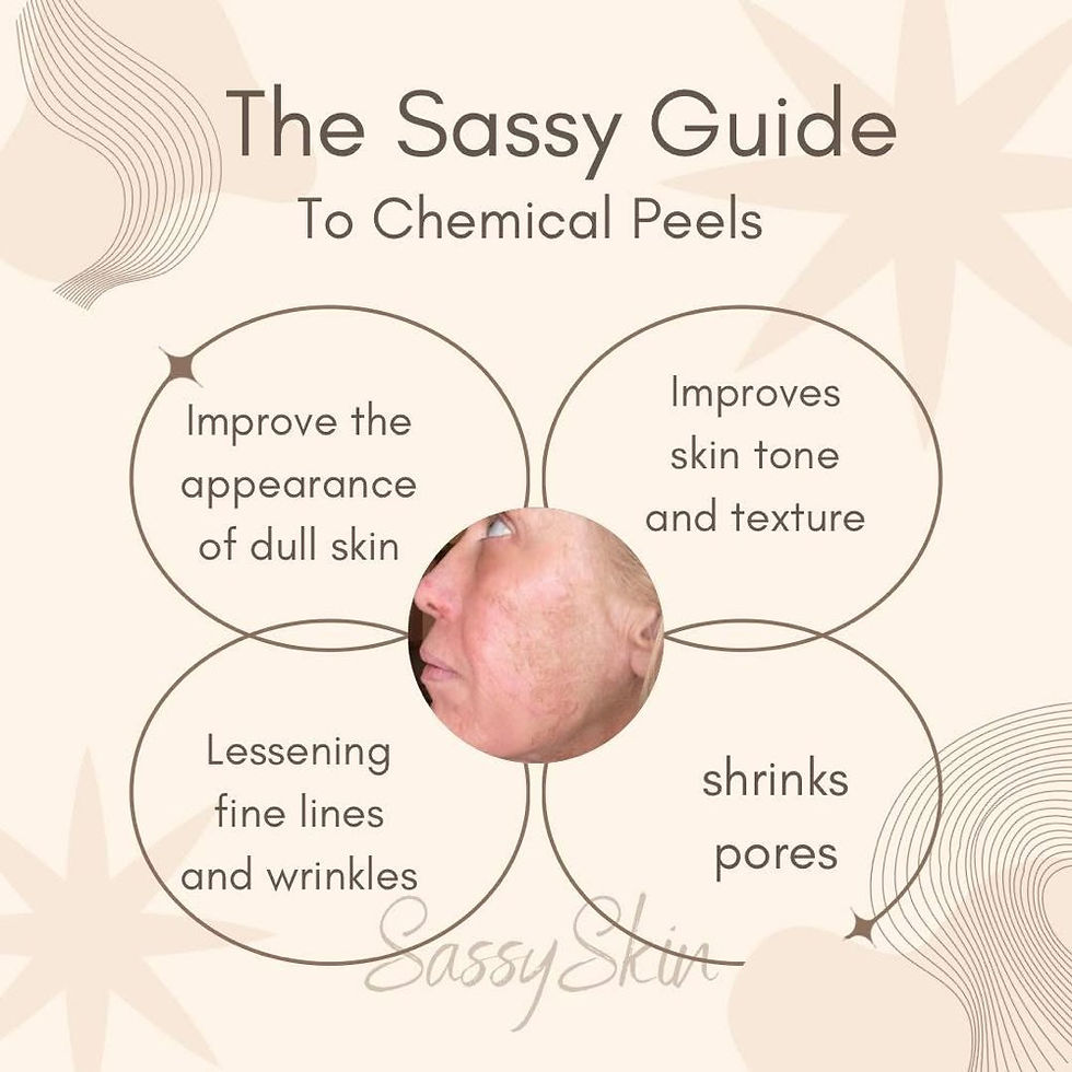 Sassy Guide to Chemical Peels