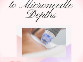 Sassy Micro Needle Depths
