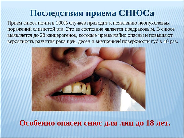 7-GX_SWFzmQMQ.jpg