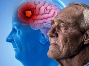 “El alcohol es el mayor detonante del Alzheimer”: Dr. Arturo Mendoza