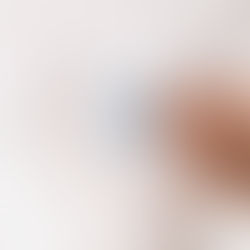 “El cáncer de próstata no da síntomas”: Dr. Arturo Mendoza