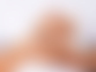 “El vitiligo afecta a 2% de la población mundial”: Dr. Arturo Mendoza 