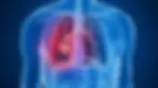 “El Cáncer de pulmón es uno de los más agresivos”: Dr. Arturo Mendoza 