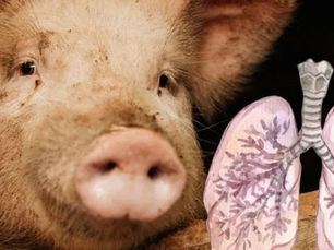 Realizan primer trasplante de pulmón de cerdo a un ser humano