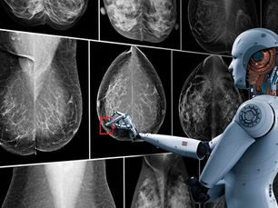 “Con AI se ha logrado mejorar la eficiencia en el diagnóstico del cáncer de mama”: Dr. Arturo Mendoza