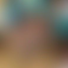 Aplica organización acupuntura para elefantes rescatados