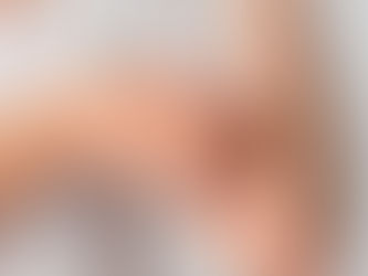 “La falta de vacunación ha ocasionado aumento de casos de sarampión en México”: Dr. Arturo Mendoza