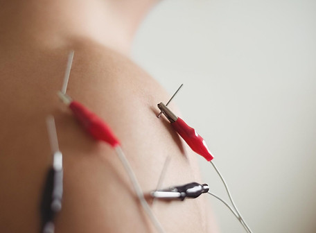 Recuperat Medicina Esportiva FISIOTERÀPIA Barcelona OSTEOPATIA  Barcelona PROVES D'ESFORÇ