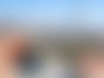 Precios de ortodoncia invisible en Tijuana