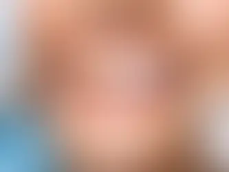 Limpieza dental antes y después sin falsas promesas