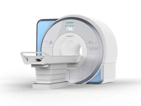 Siemens_MRI_MAGNETOM-Skyra_Image_22-right_1800000002492001.jpg