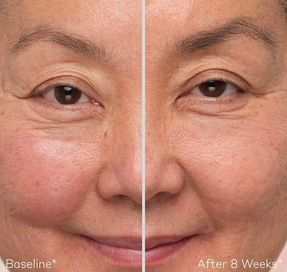 Thumbnail: OBAGI MEDICAL Nu-Cil Eyebrow Boosting Serum