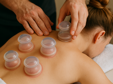 Cupping therapy session showing multiple silicone cups placed along a woman’s back to relieve muscle tension and promote circulation.