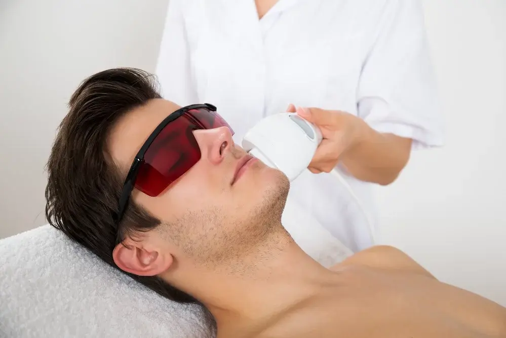 Laser Hair Removal cheeks/sideburns-10 visits