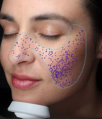 Visia pores screen