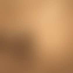 Bomberos y cáncer: entender el riesgo más allá del fuego 