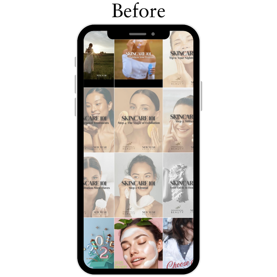 Paramedical Beauty IG Grid Before