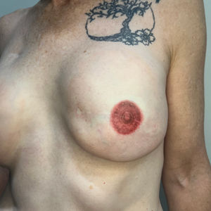 Bilateral Tattoo