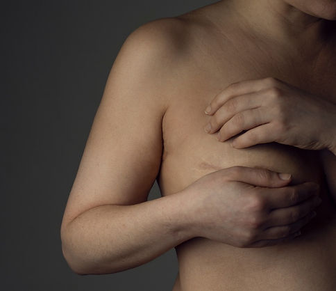 Femme cachant sa cicatrice après un cancer du sein
