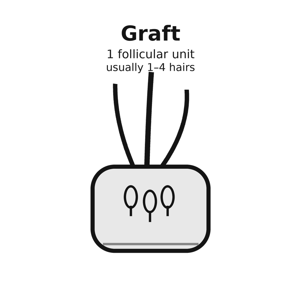 03_graft_1_follicular_unit.png