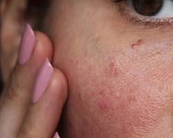 The Truth About Your Skin Barrier