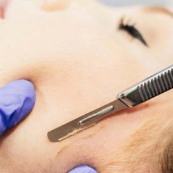 dermaplane procedure