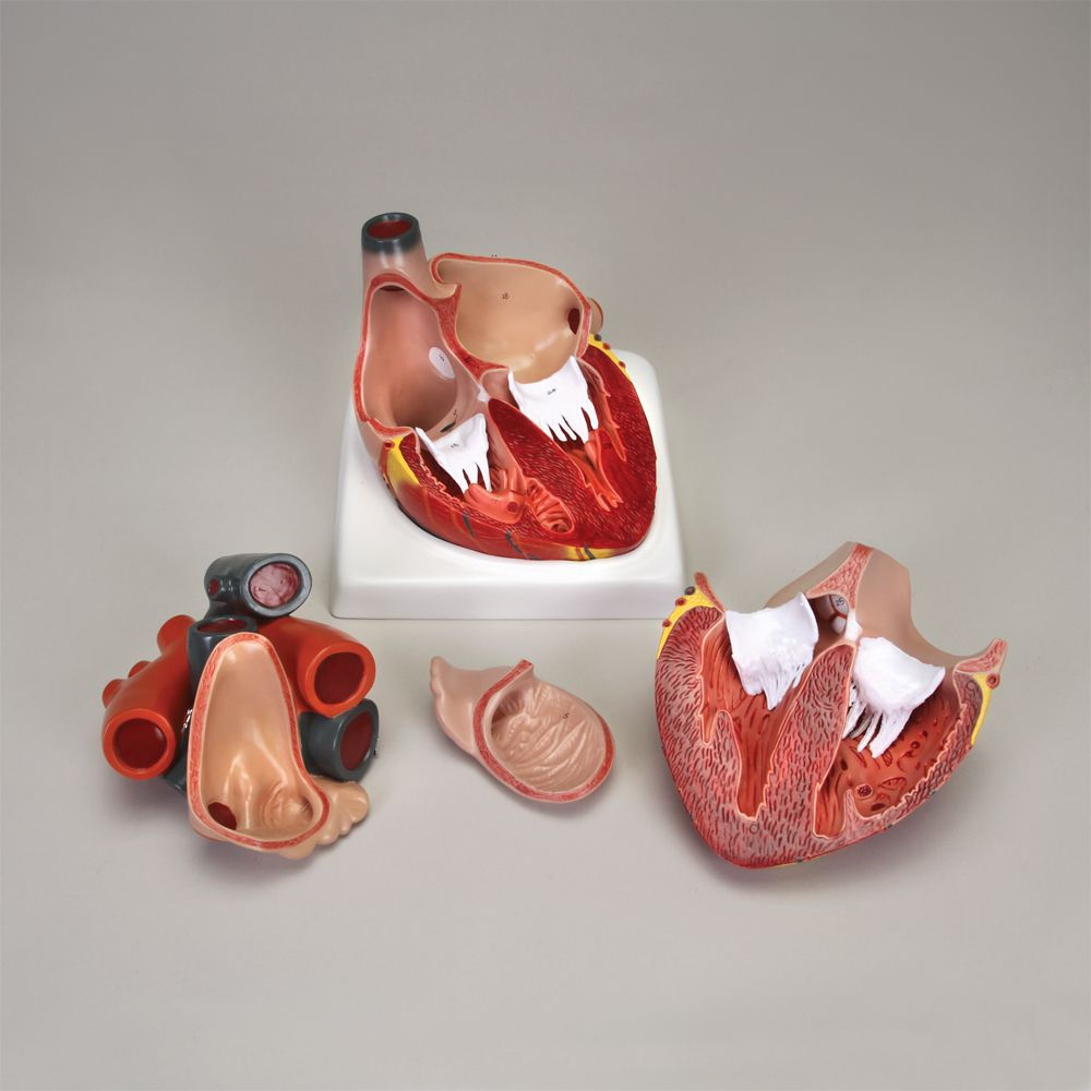 Altay Giant Heart Model, 4 Parts