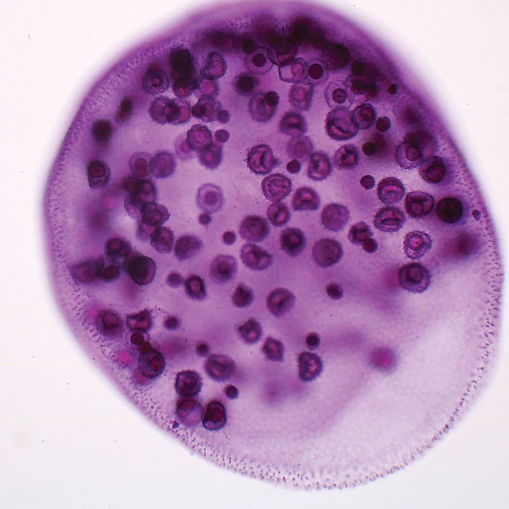 Volvox Sexual Stages and Zygotes, Microscope Slide