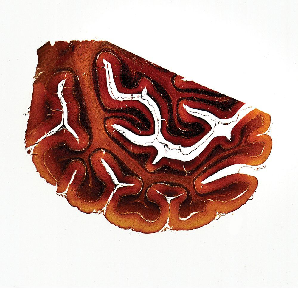 Mammal Cerebellum silver stain Microscope Slide