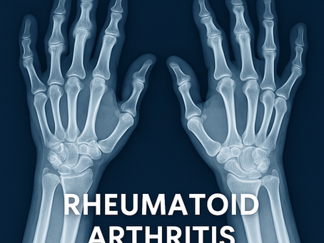What is Rheumatoid Arthritis