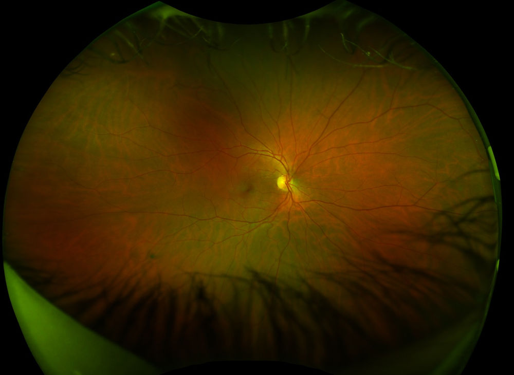 15 Awesome Benefits of Optomap (Including Why We It)