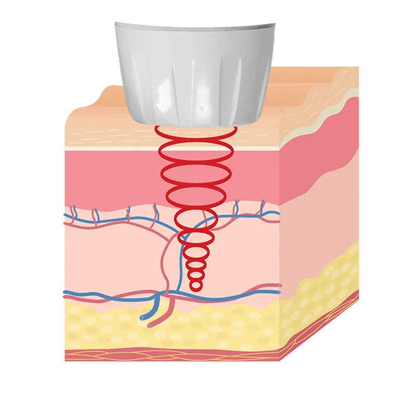 Hipro Dr Jefferson Nunes